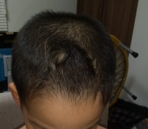 幼児　バリカン　前髪
